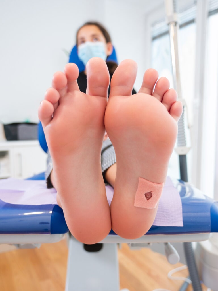 View of the bare feet of a teenage girl at the podiatrist consultation