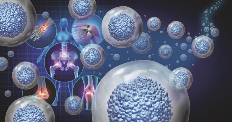 Stem Cell Therapy
