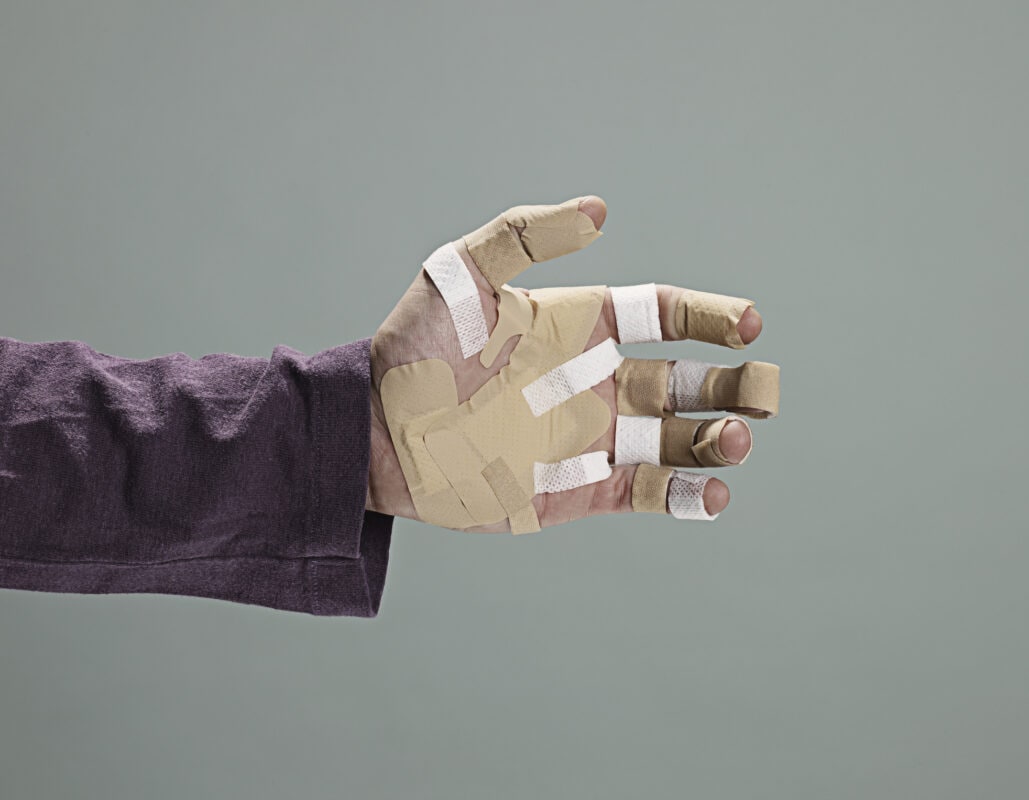 Bandages on Man's Hand