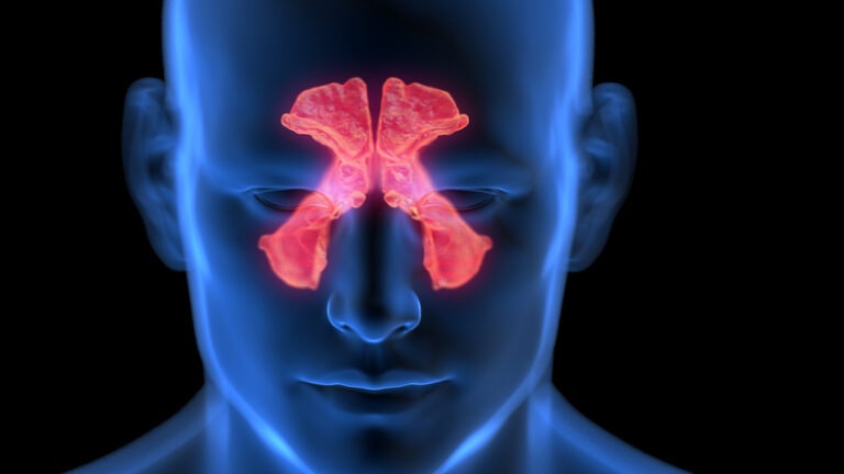 Inflamed sinuses, illustration