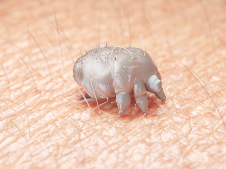 Illustration of a scabies mite on human skin