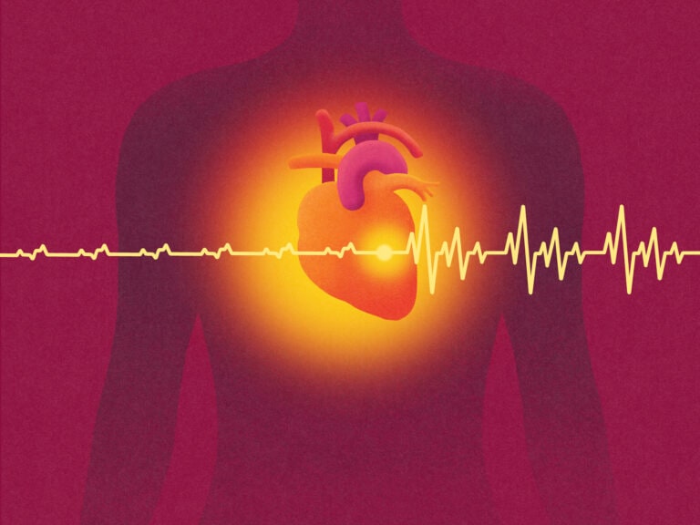 Female silhouett and heart with pacemaker