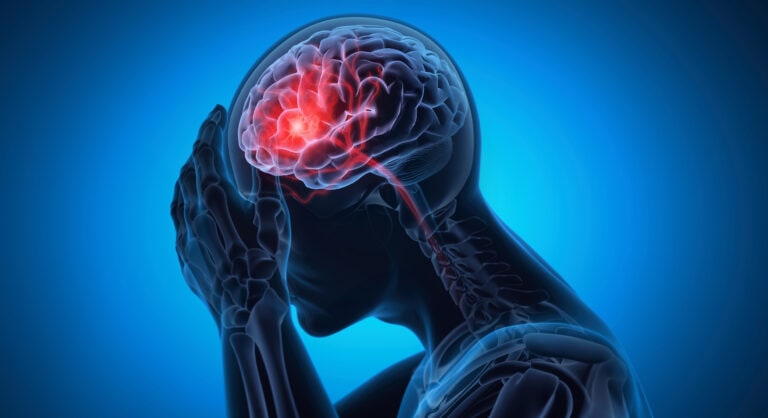 Man with brain stroke