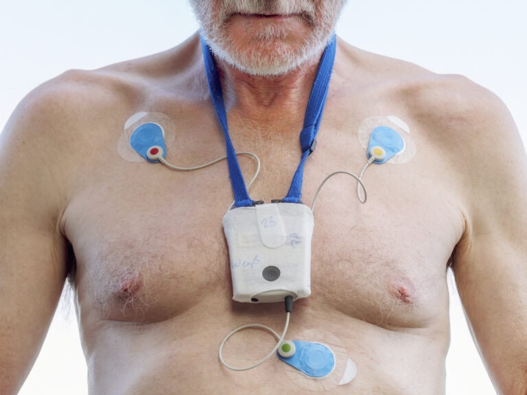 Senior man with long-term ECG on his chest, close up