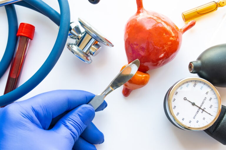 Concept photo of urological surgery, operation on prostate or bladder. Doctor with scalpel in his hand makes  incision in figure of human prostate, which is located near medical toolkit - stethoscope