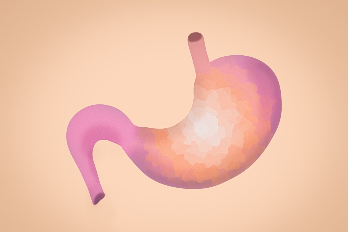Gastroenterology illustration, human stomach