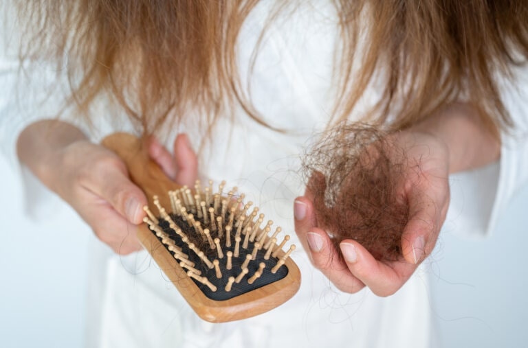 Cropped shot view of woman holding comb with hair loss after brushing her hair.