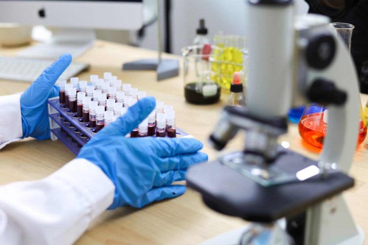 Blood test,Blood research,blood research scientist