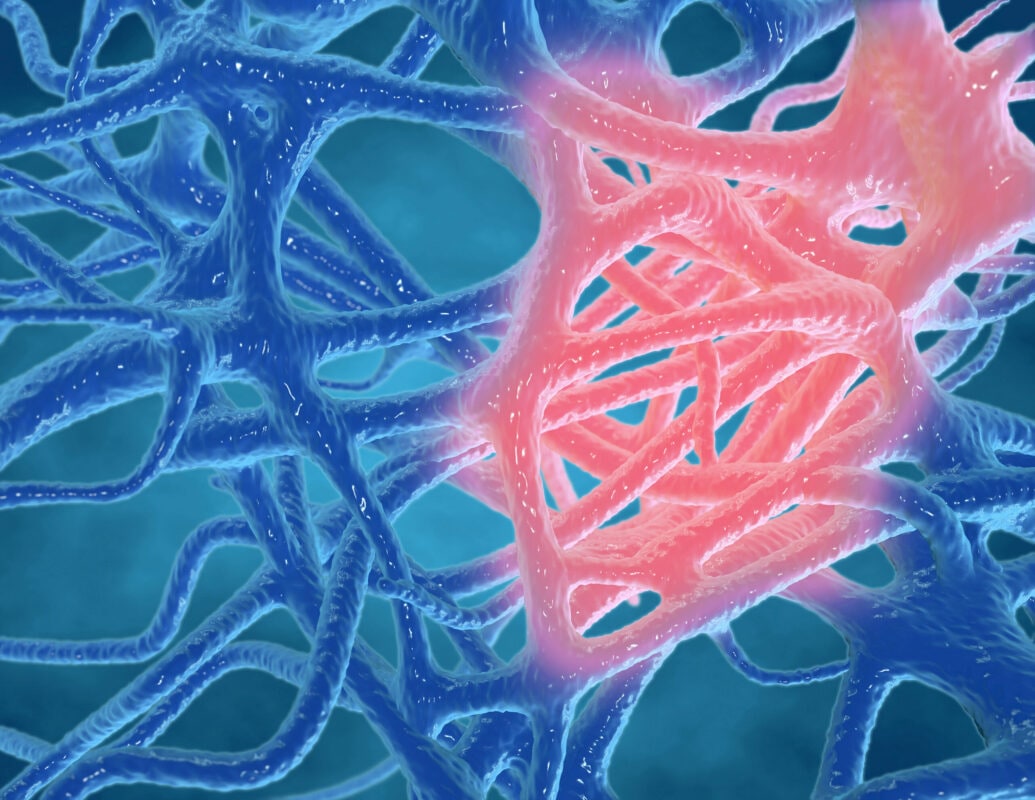 Inflammation concept, inflamed human tissues 3d rendering.