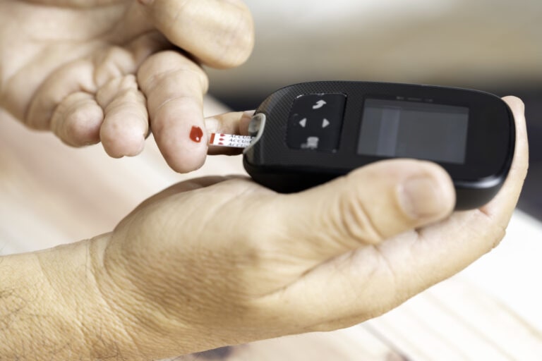 type 3 diabetes