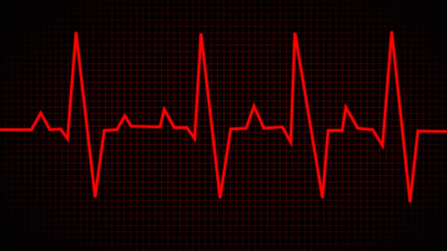 afib