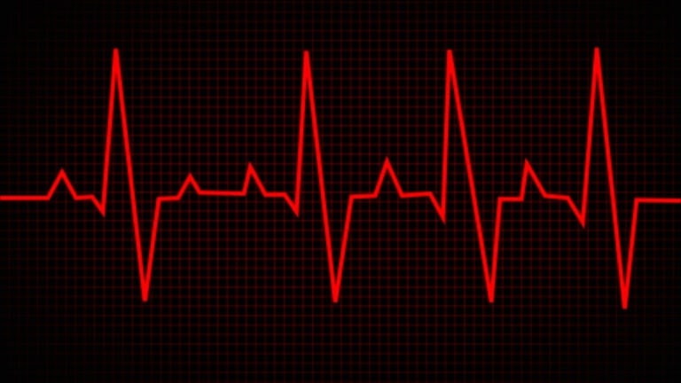 afib