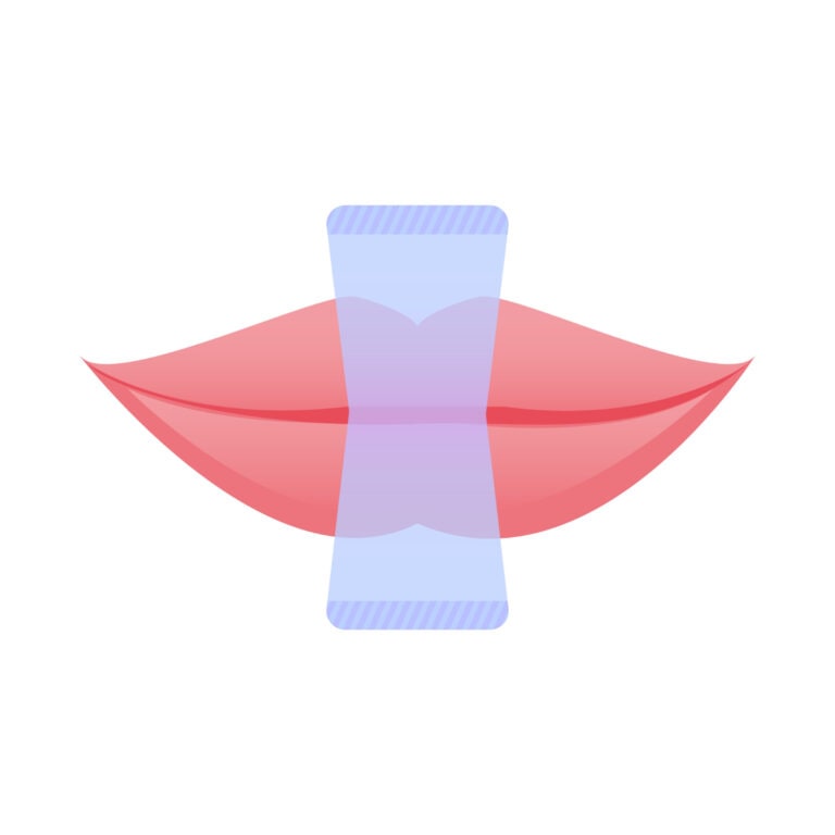 mouth taping