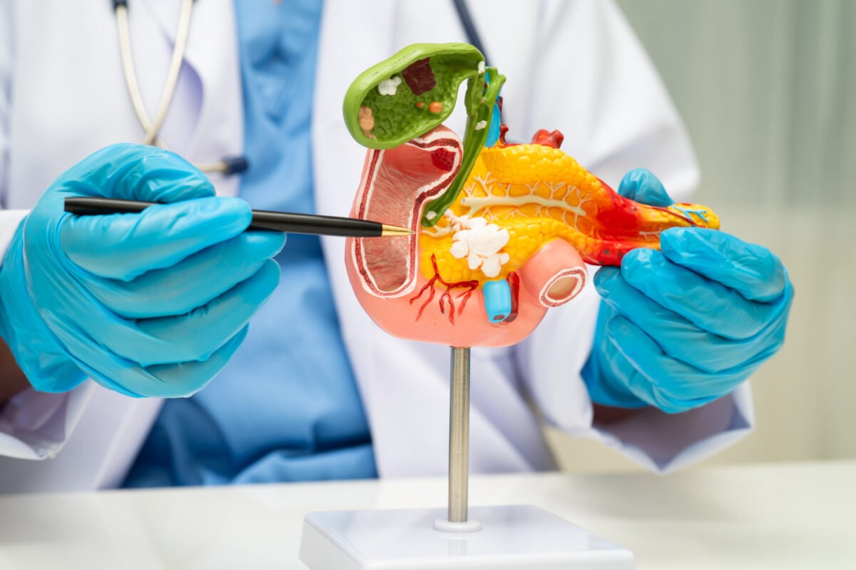 What Is Pancreatitis?