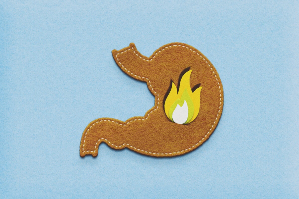 what gets rid of heartburn