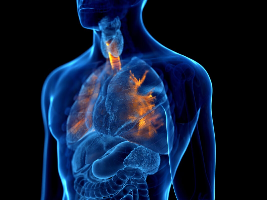 Is bronchitis contagious?
