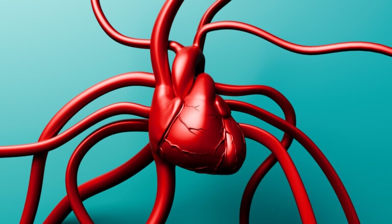 arterial calcification