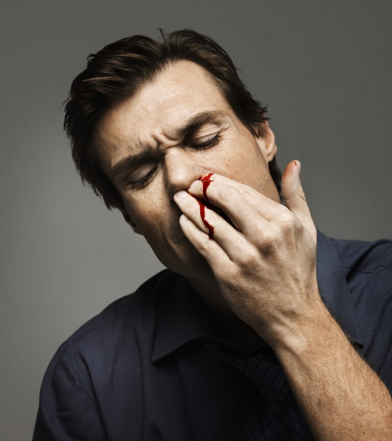 Nosebleeds are common, but when you feel dizzy and the bleeding doesn't stop you need to seek medical assistance.
