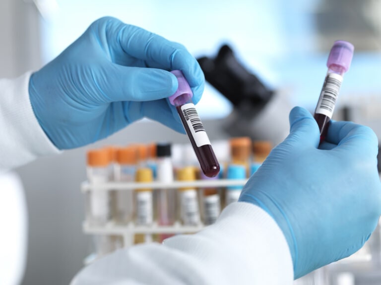 MCHC blood test