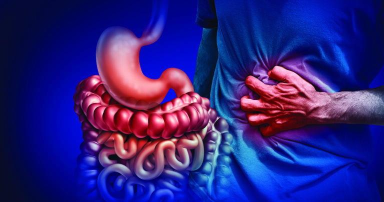Crohn’s disease