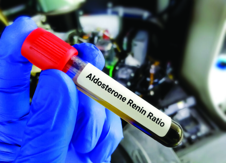 Aldosterone