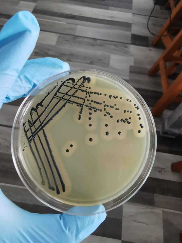 Staph Infection