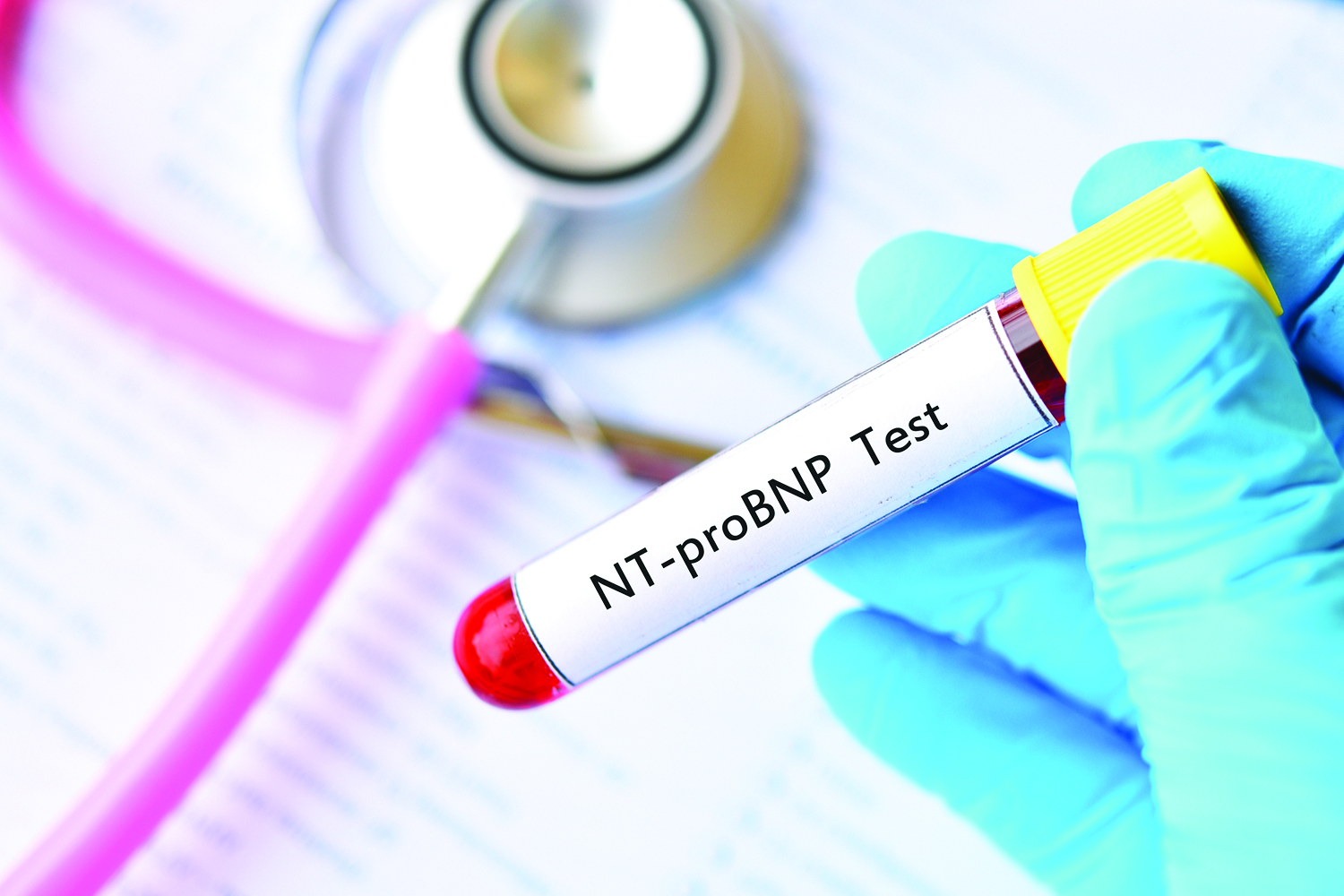 What Is a Dangerous BNP Level?