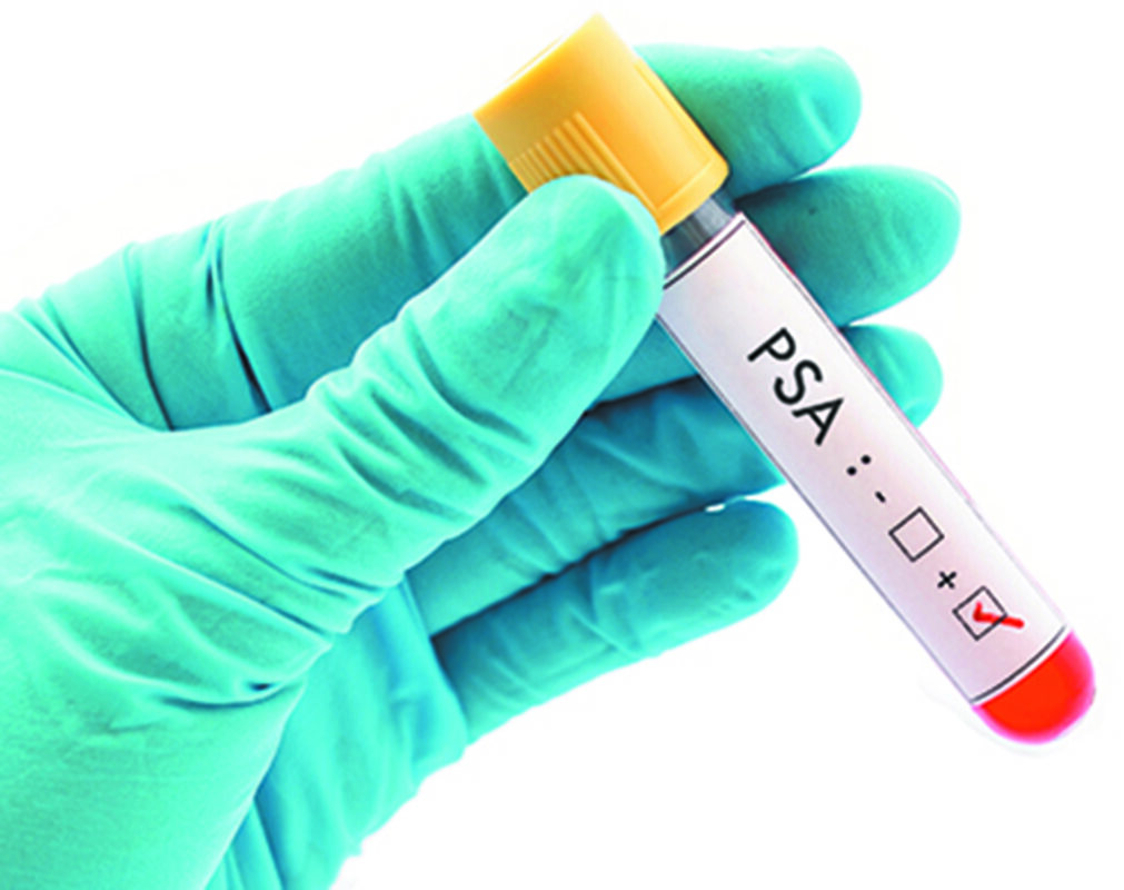 psa test