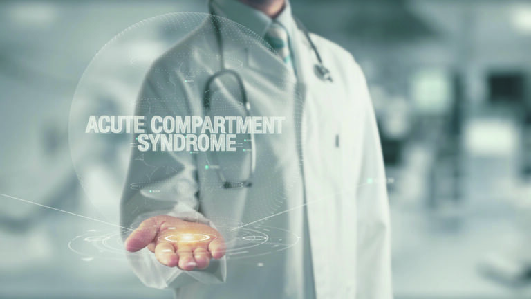 compartment syndrome