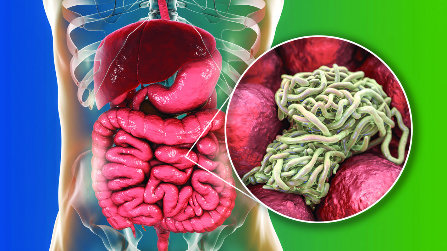 parasite cleanse