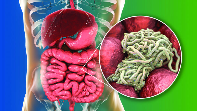 parasite cleanse