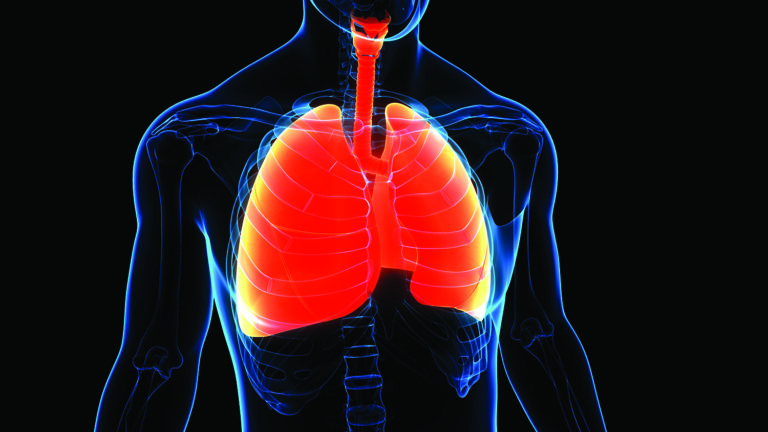 what are the 4 stages of COPD