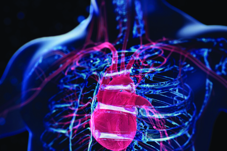 Cardiomyopathy