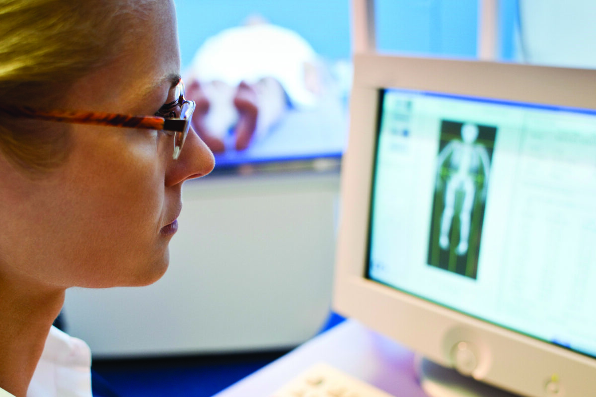 does a bone density test show cancer