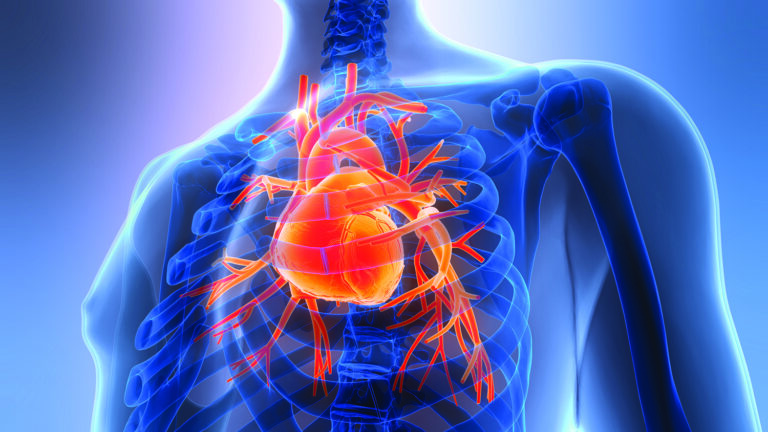 enlarged heart