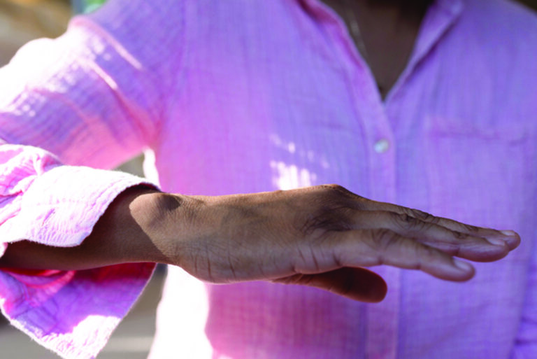 Parkinson’s disease symptoms