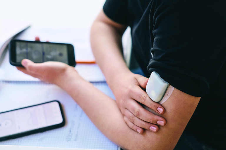 continuous glucose monitoring